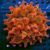Orange Rose Bubble Anemone