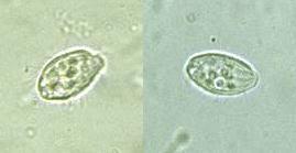 بیماری زخم عمیق (Uronema Marinum)